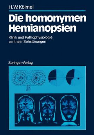 Book Die homonymen Hemianopsien Hans W. Kölmel