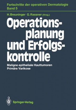 Kniha Operationsplanung und Erfolgskontrolle Helmut Breuninger