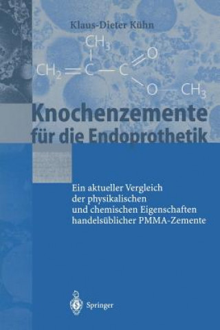 Kniha Knochenzemente F r Die Endoprothetik Klaus-Dieter Kühn