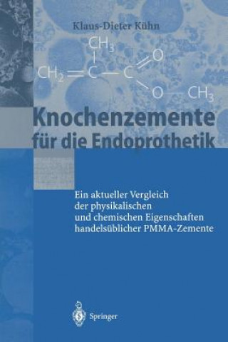 Książka Knochenzemente F r Die Endoprothetik Klaus-Dieter Kühn