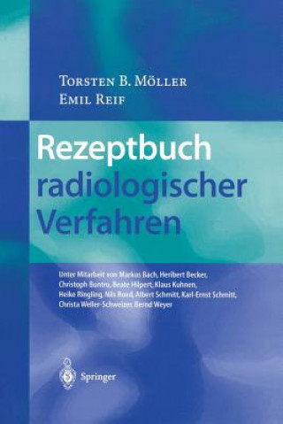 Könyv Rezeptbuch radiologischer Verfahren Torsten B. Möller