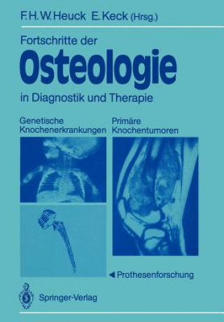Könyv Fortschritte der Osteologie in Diagnostik und Therapie Friedrich H. W. Heuck