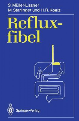 Kniha Refluxfibel Stefan A. Müller-Lissner
