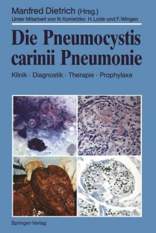 Книга Die Pneumocystis Carinii Pneumonie Manfred Dietrich