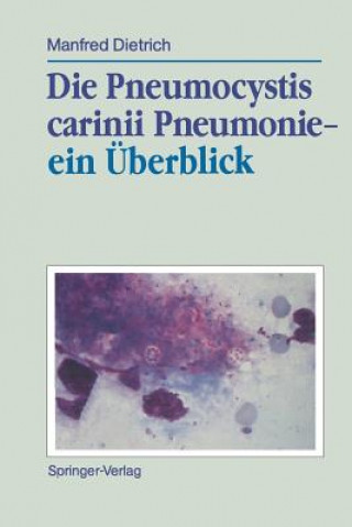 Könyv Die Pneumocystis Carinii Pneumonie- ein Uberblick Manfred Dietrich