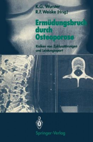 Kniha Ermudungsbruch Durch Osteoporose Roman F. Weiske