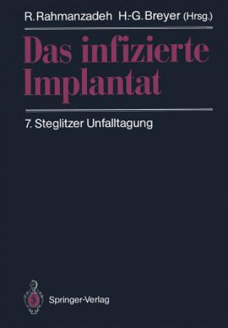 Kniha Infizierte Implantat H. -G. Breyer