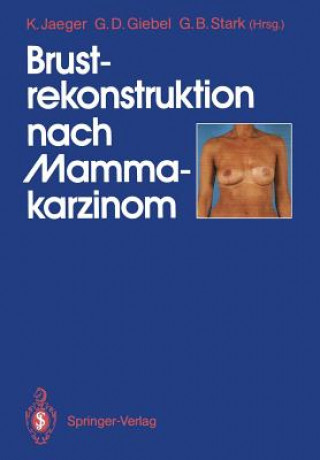 Kniha Brustrekonstruktion nach Mammakarzinom Gerald D. Giebel