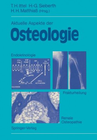 Książka Aktuelle Aspekte der Osteologie Thomas H. Ittel