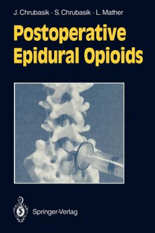 Book Postoperative Epidural Opioids Joachim Chrubasik