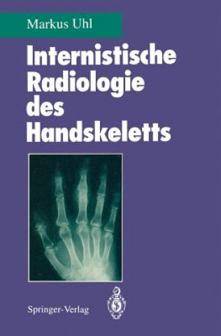 Carte Internistische Radiologie des Handskeletts Markus Uhl