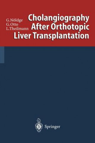 Książka Cholangiography After Orthotopic Liver Transplantation Gerd Nöldge