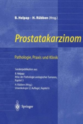 Book Prostatakarzinom - Pathologie, Praxis und Klinik Burkhard Helpap