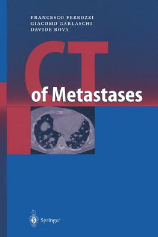 Βιβλίο CT of Metastases Francesco Ferrozzi