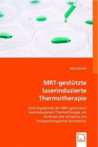 Книга MRT-gestützte laserinduzierte Thermotherapie Anja Schirbel