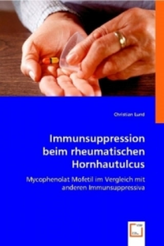 Kniha Immunsuppression beim rheumatischen Hornhautulcus Christian Lund
