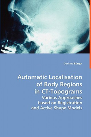 Carte Automatic Localisation of Body Regions in CT Topograms Corinna Bürger