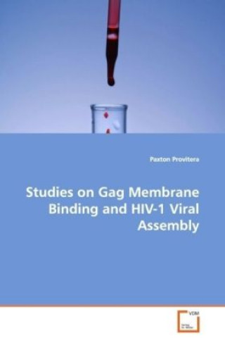 Carte Studies on Gag Membrane Binding and HIV-1 Viral Assembly Paxton Provitera