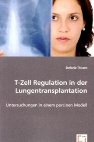 Carte T-Zell Regulation in der Lungentransplantation Stefanie Thissen