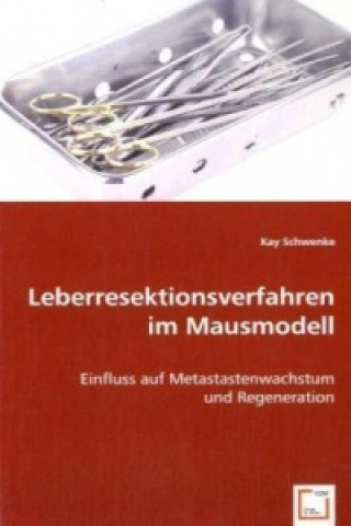 Kniha Leberresektionsverfahren im Mausmodell Kay Schwenke