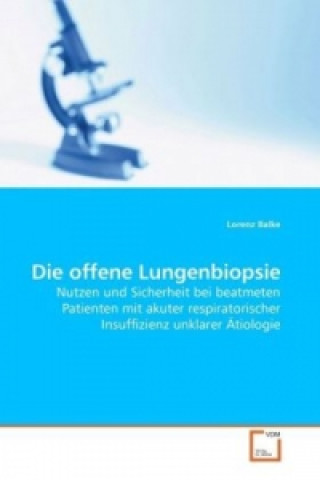 Kniha Die offene Lungenbiopsie Lorenz Balke