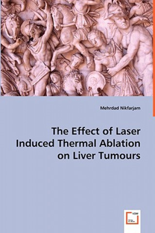 Carte Effect of Laser Induced Thermal Ablation on Liver Tumours Mehrdad Nikfarjam
