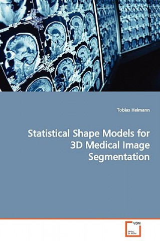 Книга Statistical Shape Models for 3D Medical Image Segmentation Tobias Heimann