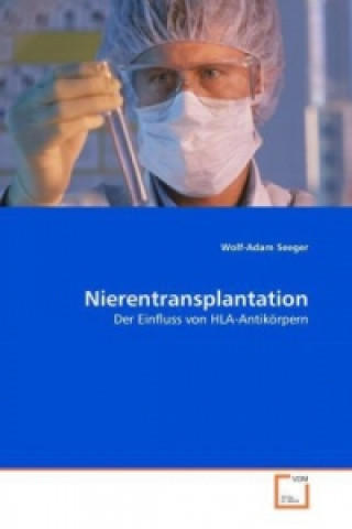 Kniha Nierentransplantation Wolf-Adam Seeger