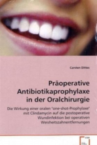 Kniha Präoperative Antibiotikaprophylaxe in der Oralchirurgie Carsten Dittes