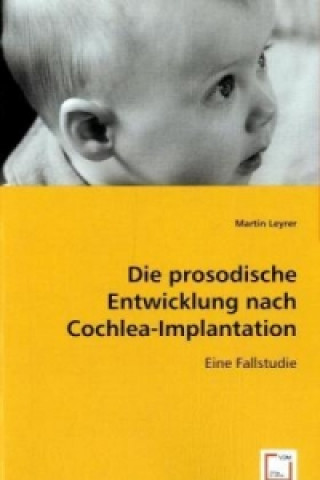 Livre Die prosodische Entwicklung nach Cochlea-Implantation Martin Leyrer