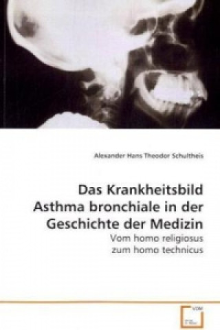 Kniha Das Krankheitsbild Asthma bronchiale in der Geschichte der Medizin Alexander H. Th. Schultheis