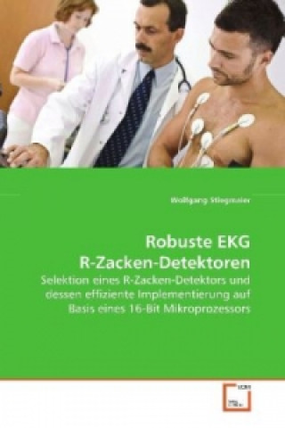 Könyv Robuste EKG R-Zacken-Detektoren Wolfgang Stiegmaier