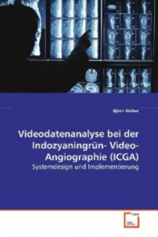 Livre Videodatenanalyse bei der Indozyaningrün- Video-Angiographie (ICGA) Björn Weber