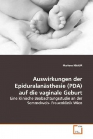 Carte Auswirkungen der Epiduralanästhesie (PDA) auf die vaginale Geburt Marlene Knaur