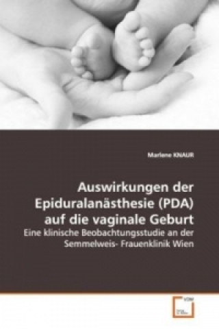 Buch Auswirkungen der Epiduralanästhesie (PDA) auf die vaginale Geburt Marlene Knaur