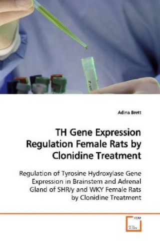 Carte TH Gene Expression Regulation Female Rats by Clonidine Treatment Adina Brett