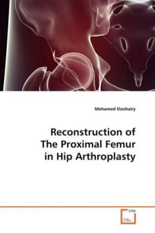 Knjiga Reconstruction of The Proximal Femur in Hip Arthroplasty Mohamed Elzohairy