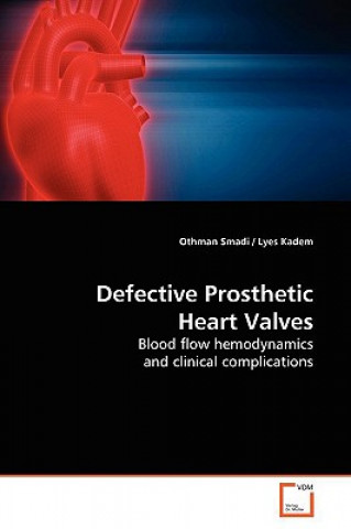 Книга Defective Prosthetic Heart Valves Othman Smadi