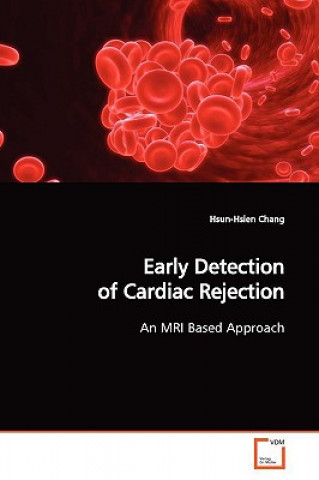 Könyv Early Detection of Cardiac Rejection Hsun-Hsien Chang
