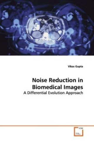 Könyv Noise Reduction in Biomedical Images Vikas Gupta