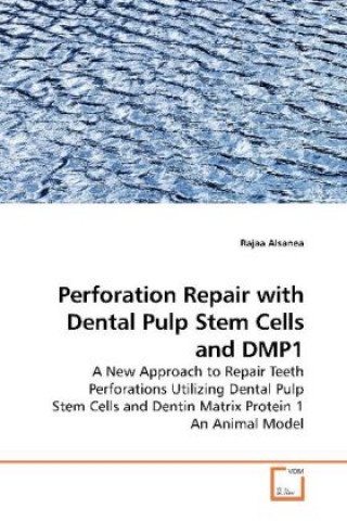 Könyv Perforation Repair with Dental Pulp Stem Cells and DMP1 Rajaa Alsanea