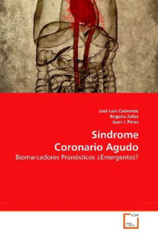 Carte Síndrome Coronario Agudo José Luis Cabrerizo