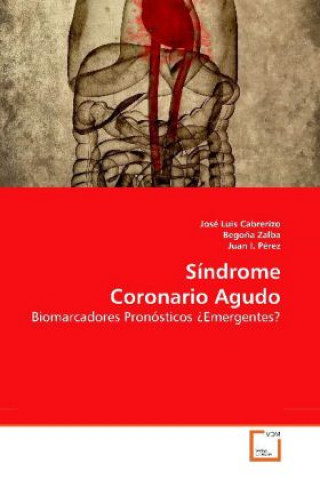 Książka Síndrome Coronario Agudo José Luis Cabrerizo