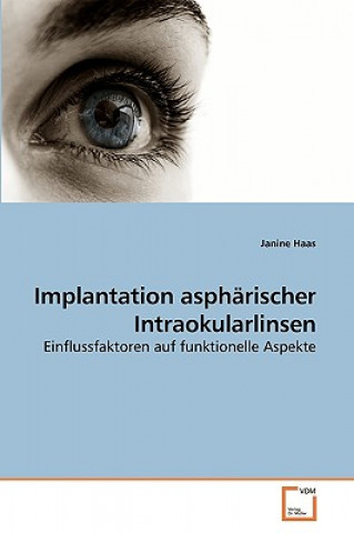 Carte Implantation aspharischer Intraokularlinsen Janine Haas