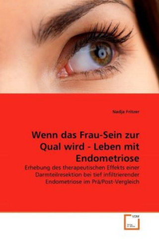 Kniha Wenn das Frau-Sein zur Qual wird - Leben mit Endometriose Nadja Fritzer