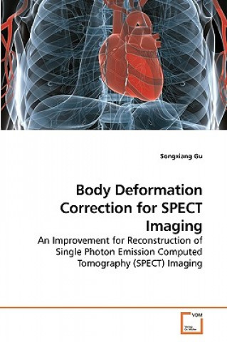 Könyv Body Deformation Correction for SPECT Imaging Songxiang Gu
