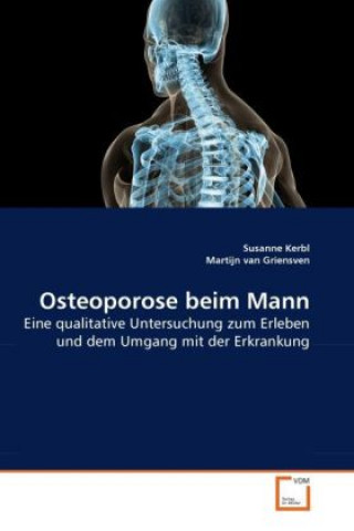 Книга Osteoporose beim Mann Susanne Kerbl