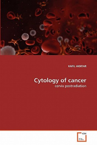 Könyv Cytology of cancer Kafil Akthar