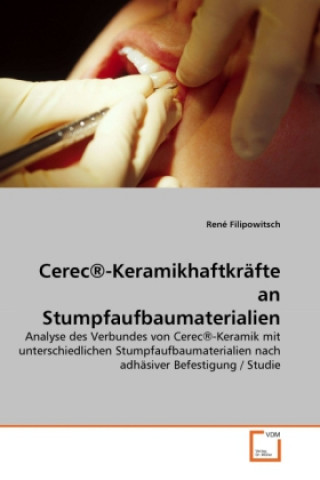 Książka Cerec®-Keramikhaftkräfte an Stumpfaufbaumaterialien René Filipowitsch