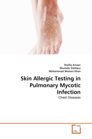 Carte Skin Allergic Testing in Pulmonary Mycotic Infection Shafiq Anwar
